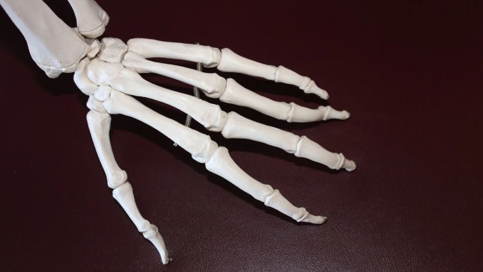 Artrite reumatoide - Ossa della mano